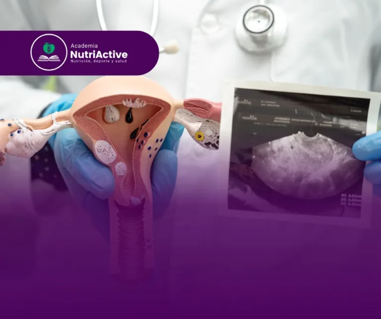 Síndrome de ovario poliquístico: Nutrición y tratamiento.